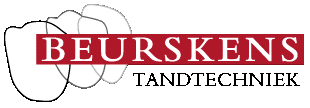 Beurskens